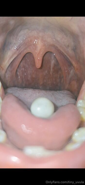 tiny_uvula