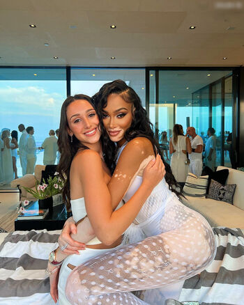 Winnie Harlow